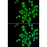 Immunofluorescence - IL20 antibody from Signalway Antibody (39056) - Antibodies.com