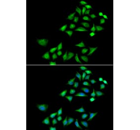 Immunofluorescence - KLK4 antibody from Signalway Antibody (39065) - Antibodies.com
