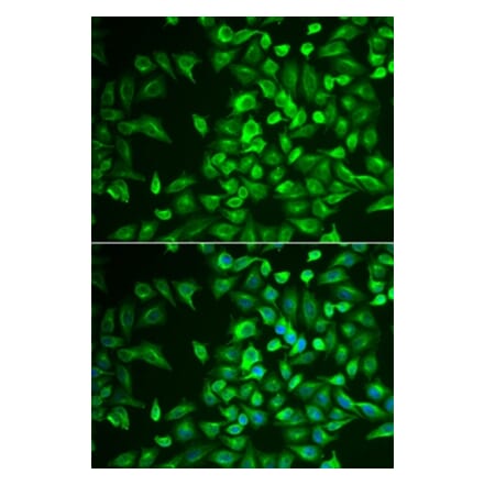 Immunofluorescence - LRAT antibody from Signalway Antibody (39069) - Antibodies.com