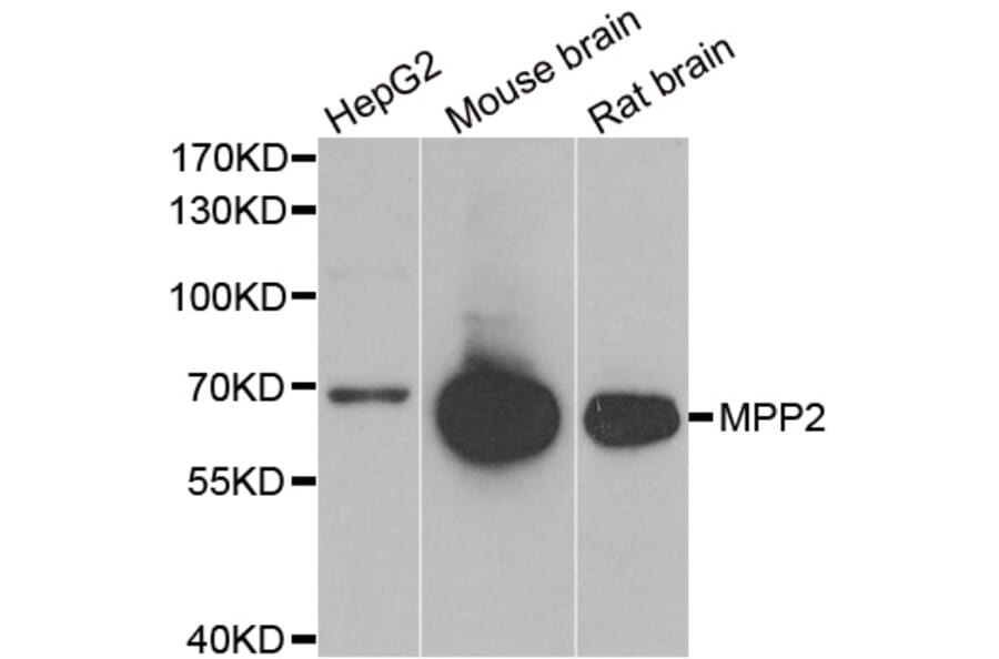 Western blot - MPP2 antibody from Signalway Antibody (39079) - Antibodies.com