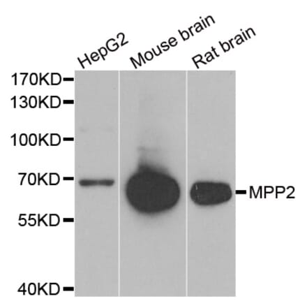 Western blot - MPP2 antibody from Signalway Antibody (39079) - Antibodies.com