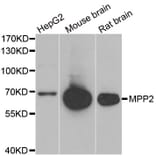 Western blot - MPP2 antibody from Signalway Antibody (39079) - Antibodies.com