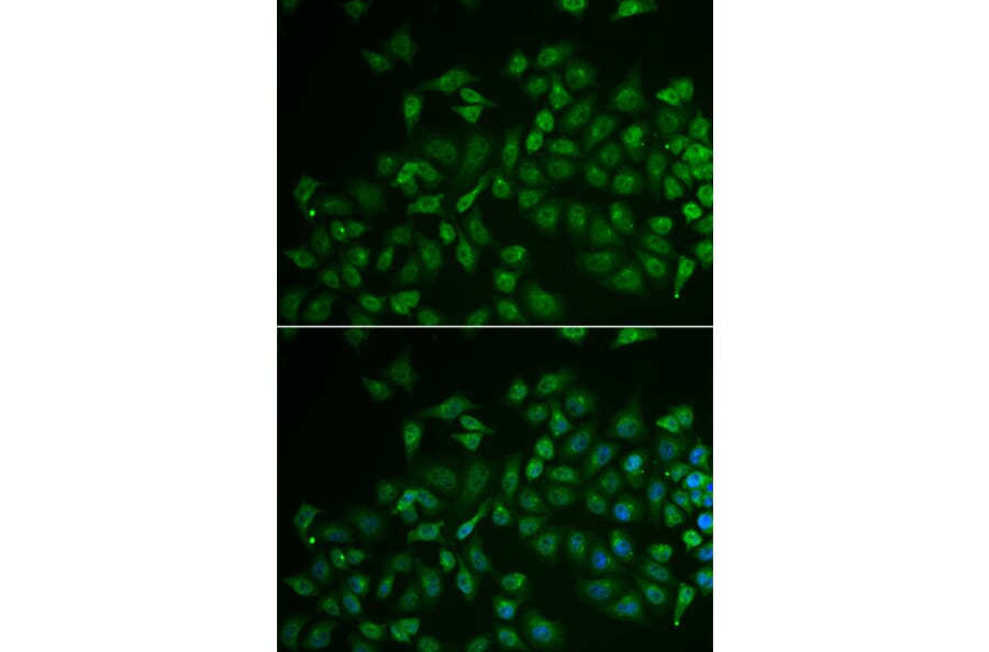 Immunofluorescence - MPP2 antibody from Signalway Antibody (39079) - Antibodies.com