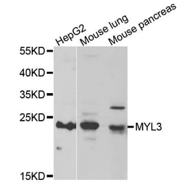 Western blot - MYL3 antibody from Signalway Antibody (39082) - Antibodies.com