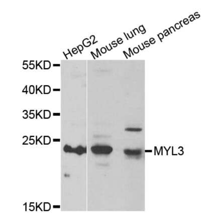 Western blot - MYL3 antibody from Signalway Antibody (39082) - Antibodies.com