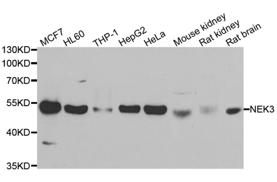 Western blot - NEK3 antibody from Signalway Antibody (39085) - Antibodies.com