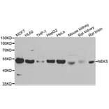 Western blot - NEK3 antibody from Signalway Antibody (39085) - Antibodies.com