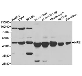 Western blot - NFS1 antibody from Signalway Antibody (39088) - Antibodies.com