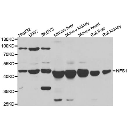 Western blot - NFS1 antibody from Signalway Antibody (39088) - Antibodies.com