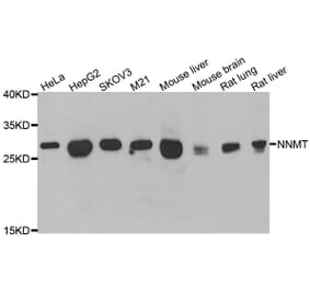 Western blot - NNMT antibody from Signalway Antibody (39090) - Antibodies.com