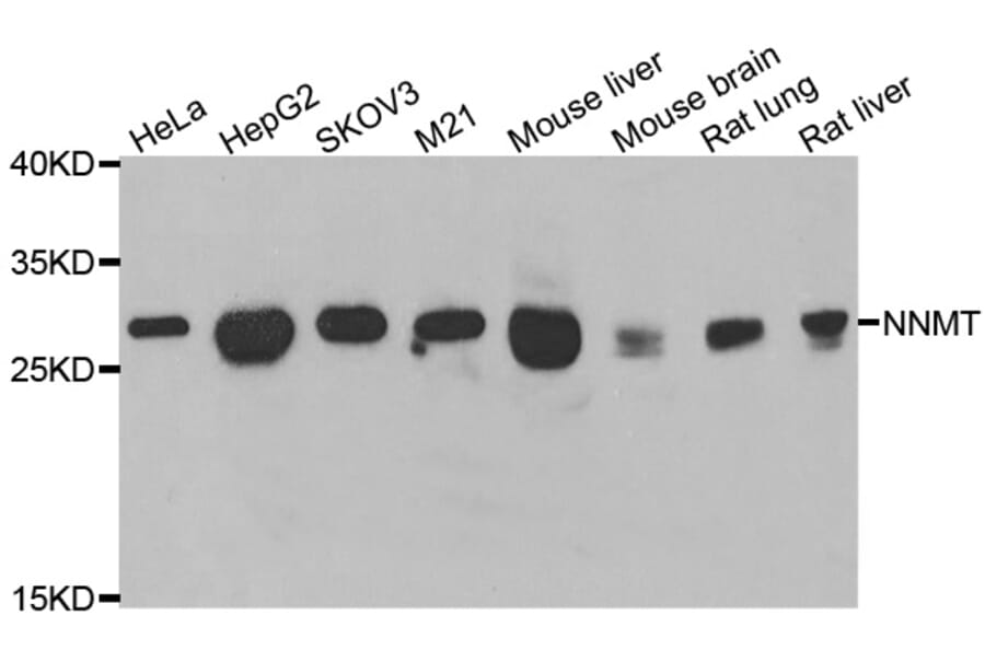 Western blot - NNMT antibody from Signalway Antibody (39090) - Antibodies.com