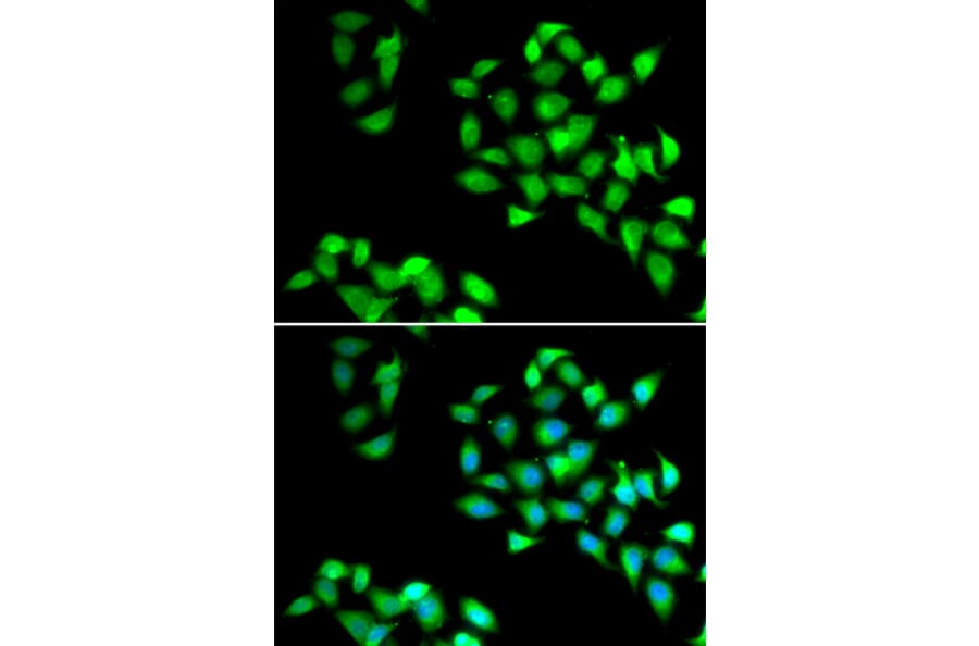 Immunofluorescence - NNMT antibody from Signalway Antibody (39090) - Antibodies.com