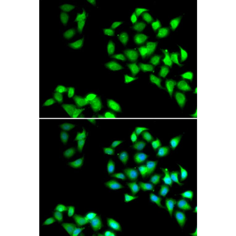 Immunofluorescence - NNMT antibody from Signalway Antibody (39090) - Antibodies.com