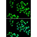 Immunofluorescence - NNMT antibody from Signalway Antibody (39090) - Antibodies.com