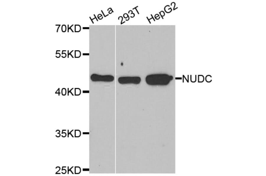 Western blot - NUDC antibody from Signalway Antibody (39094) - Antibodies.com