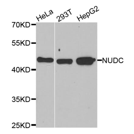 Western blot - NUDC antibody from Signalway Antibody (39094) - Antibodies.com