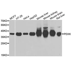 Western blot - PDXK antibody from Signalway Antibody (39101) - Antibodies.com