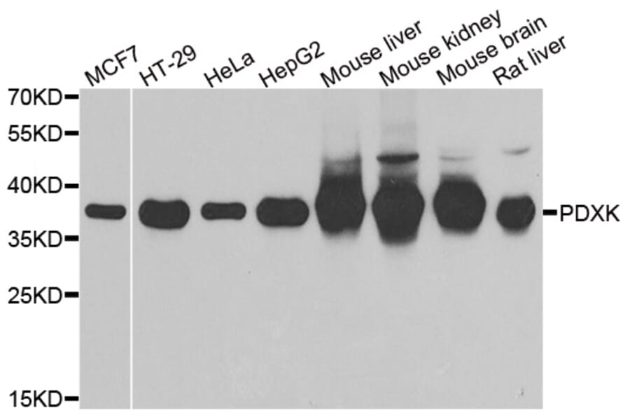 Western blot - PDXK antibody from Signalway Antibody (39101) - Antibodies.com