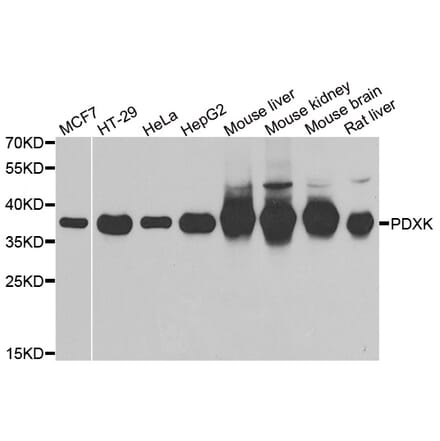 Western blot - PDXK antibody from Signalway Antibody (39101) - Antibodies.com
