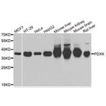 Western blot - PDXK antibody from Signalway Antibody (39101) - Antibodies.com