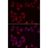 Immunofluorescence - PDXK antibody from Signalway Antibody (39101) - Antibodies.com
