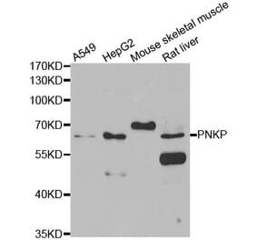 Western blot - PNKP antibody from Signalway Antibody (39107) - Antibodies.com