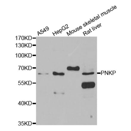 Western blot - PNKP antibody from Signalway Antibody (39107) - Antibodies.com