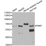 Western blot - PNKP antibody from Signalway Antibody (39107) - Antibodies.com