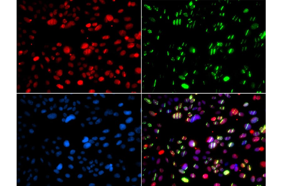 Immunofluorescence - PNKP antibody from Signalway Antibody (39107) - Antibodies.com