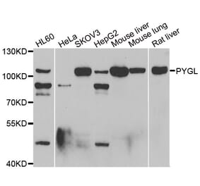 Western blot - PYGL antibody from Signalway Antibody (39121) - Antibodies.com