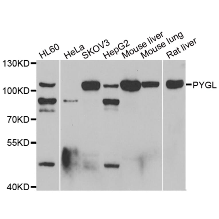 Western blot - PYGL antibody from Signalway Antibody (39121) - Antibodies.com