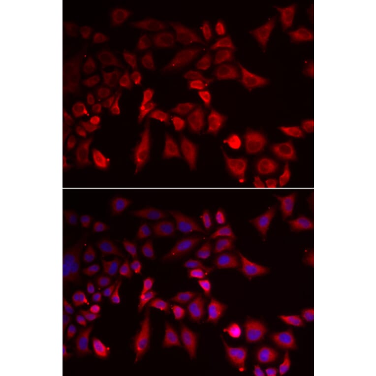 Immunofluorescence - PYGL antibody from Signalway Antibody (39121) - Antibodies.com