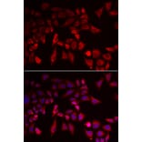 Immunofluorescence - PYGL antibody from Signalway Antibody (39121) - Antibodies.com