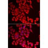 Immunofluorescence - QPCT antibody from Signalway Antibody (39122) - Antibodies.com