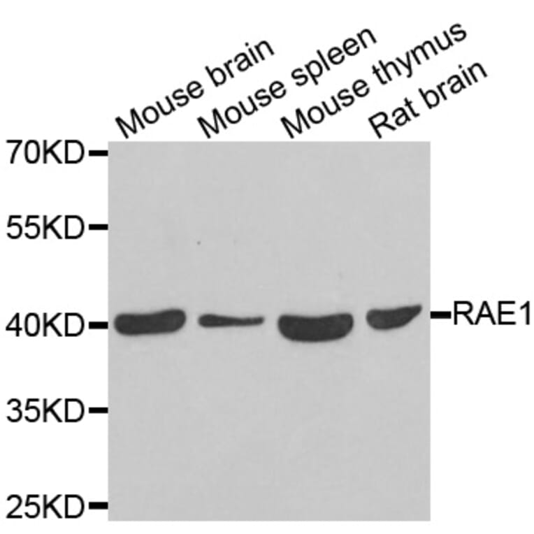 Western blot - RAE1 antibody from Signalway Antibody (39124) - Antibodies.com