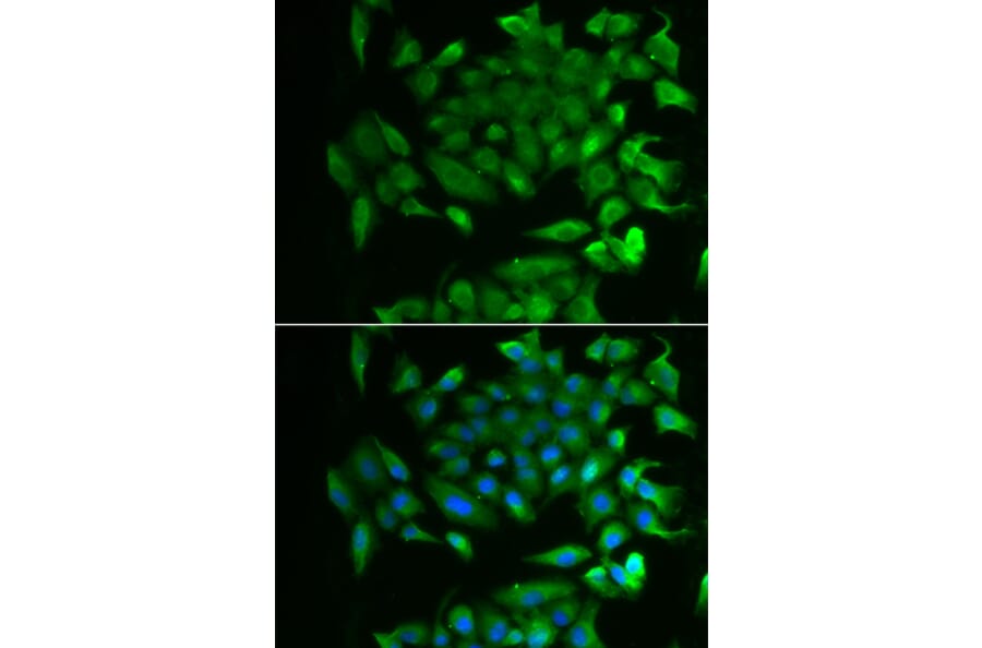 Immunofluorescence - RBP2 antibody from Signalway Antibody (39127) - Antibodies.com