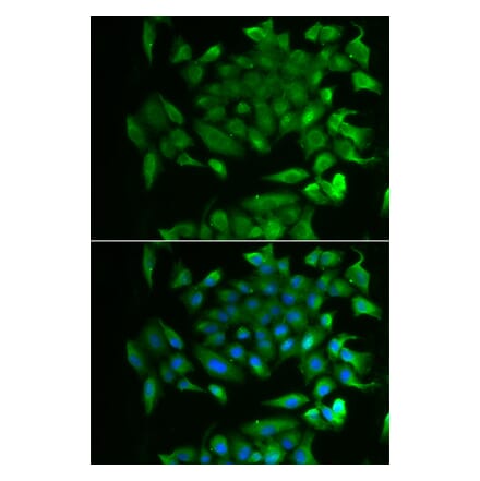 Immunofluorescence - RBP2 antibody from Signalway Antibody (39127) - Antibodies.com