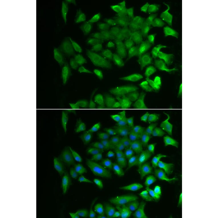 Immunofluorescence - RBP2 antibody from Signalway Antibody (39127) - Antibodies.com