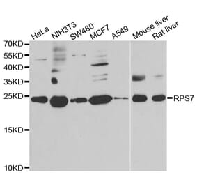 Western blot - RPS7 antibody from Signalway Antibody (39137) - Antibodies.com