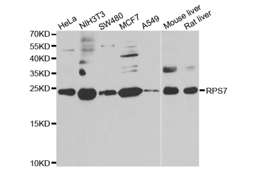 Western blot - RPS7 antibody from Signalway Antibody (39137) - Antibodies.com