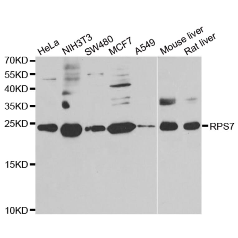 Western blot - RPS7 antibody from Signalway Antibody (39137) - Antibodies.com