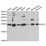 Western blot - RPS7 antibody from Signalway Antibody (39137) - Antibodies.com