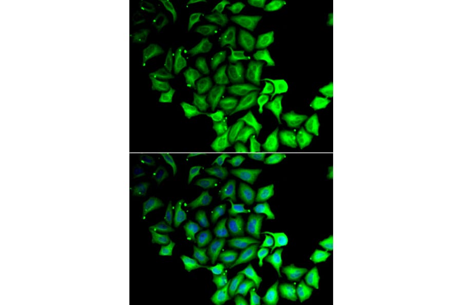 Immunofluorescence - RPS7 antibody from Signalway Antibody (39137) - Antibodies.com