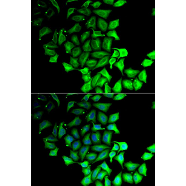 Immunofluorescence - RPS7 antibody from Signalway Antibody (39137) - Antibodies.com