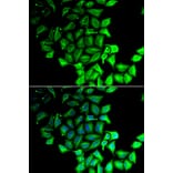 Immunofluorescence - RPS7 antibody from Signalway Antibody (39137) - Antibodies.com