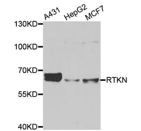 Western blot - RTKN antibody from Signalway Antibody (39138) - Antibodies.com