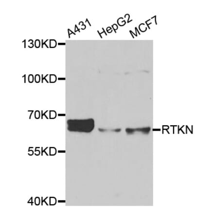 Western blot - RTKN antibody from Signalway Antibody (39138) - Antibodies.com