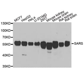 Western blot - SARS antibody from Signalway Antibody (39139) - Antibodies.com