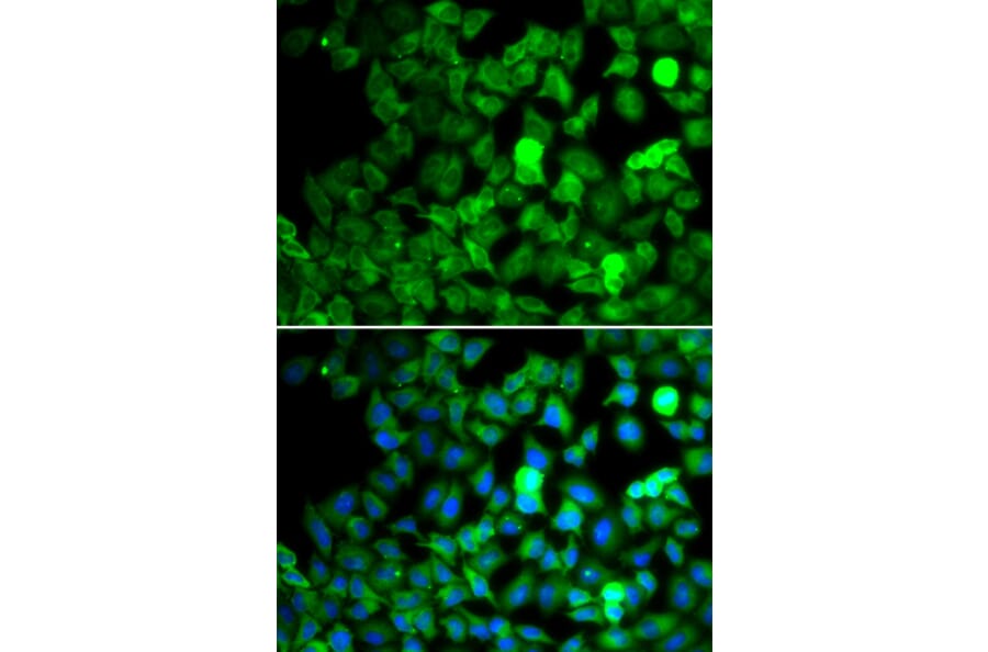 Immunofluorescence - SARS antibody from Signalway Antibody (39139) - Antibodies.com