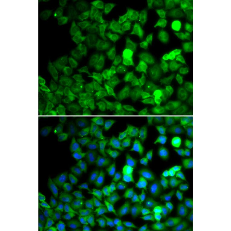 Immunofluorescence - SARS antibody from Signalway Antibody (39139) - Antibodies.com
